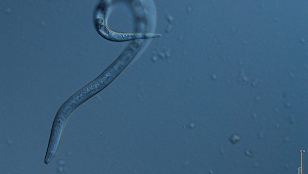 Imagen microscópica de un nemátodo, mostrando su cuerpo alargado y translúcido con una leve curvatura. El fondo azul resalta los detalles internos del organismo, caracterÃ­stico de estos pequeños gusanos que habitan en el suelo y pueden ser fitoparásitos o beneficiosos para las plantas.