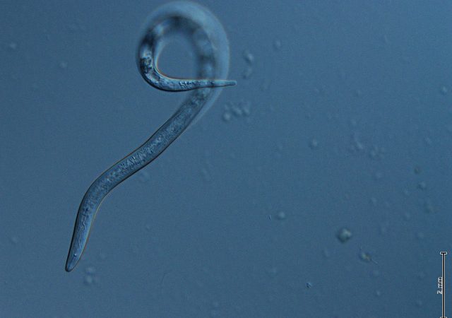 Imagen microscópica de un nemátodo, mostrando su cuerpo alargado y translúcido con una leve curvatura. El fondo azul resalta los detalles internos del organismo, caracterÃ­stico de estos pequeños gusanos que habitan en el suelo y pueden ser fitoparásitos o beneficiosos para las plantas.