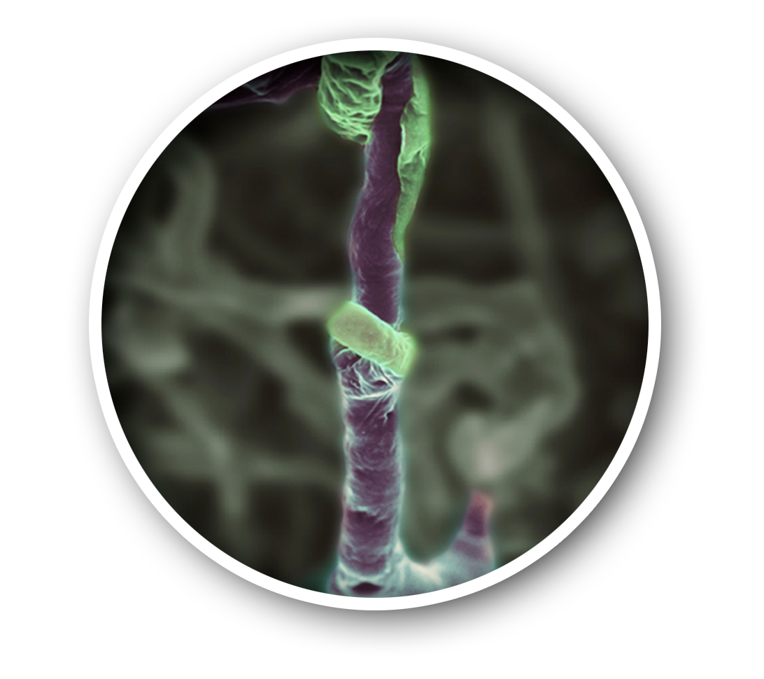 Trichoderma asperellum cepa T34 parasitando Didymella