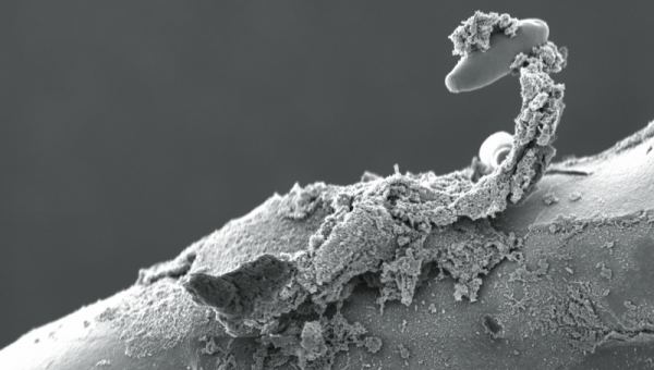 Cultivos protegidos por T34 Biocontrol contra Rhizoctonia spp.